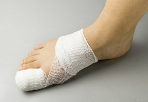 Вывих пальца на ноге. Как определить вывих пальца Лечение