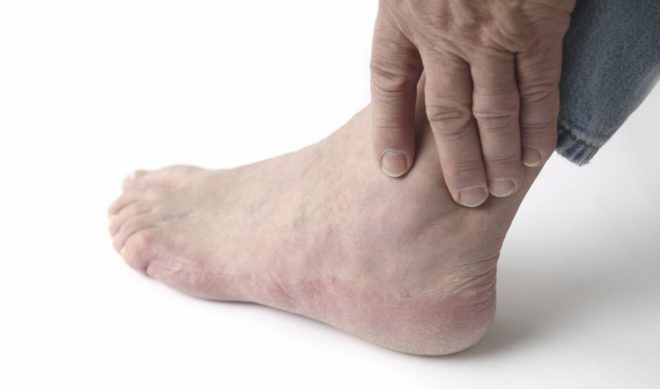 Комплексы лечебных упражнений для стопы ног при артрозе