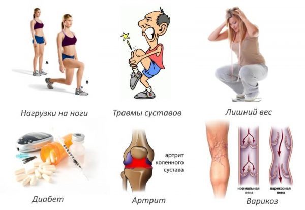 Причины остеоартроза коленного сустава