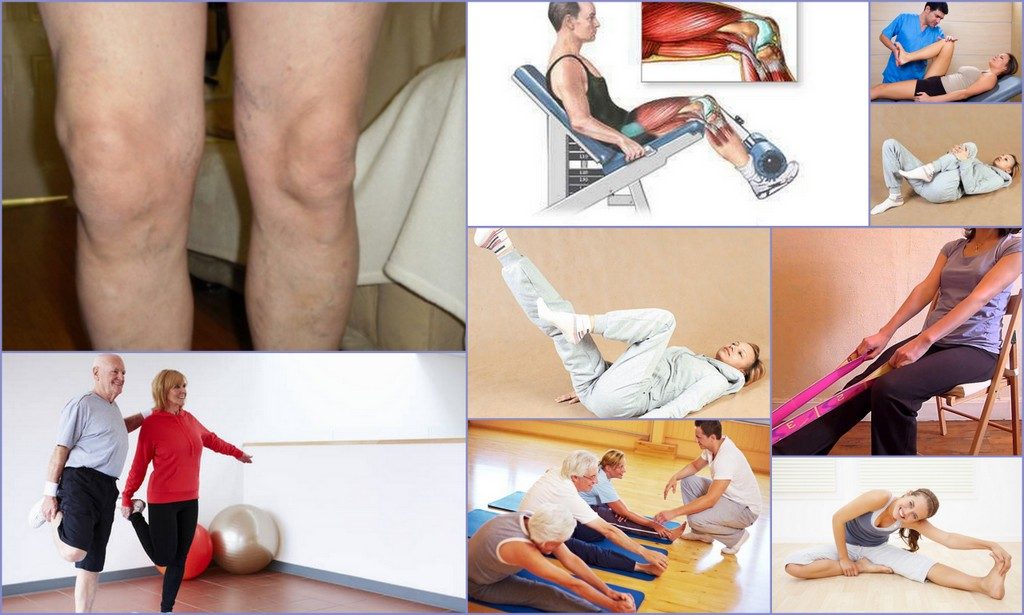 Упражнение при артрозе коленного сустава 