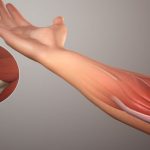 Артроз локтевого сустава: лечение и причины остеоартроза