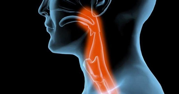 Глоточно-гортанный синдром сопровождается ощущением кома в горле
