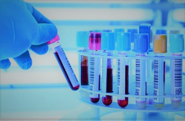 Биохимический анализ крови позволит узнать множество важных данныханализ крови позволит узнать множество важных моментов