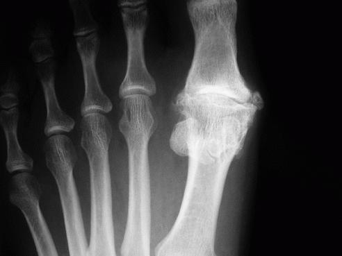 Рентген - один из методов диагностики