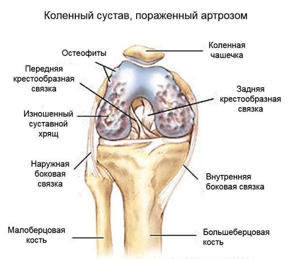Лфк при удалении мениска коленного сустава