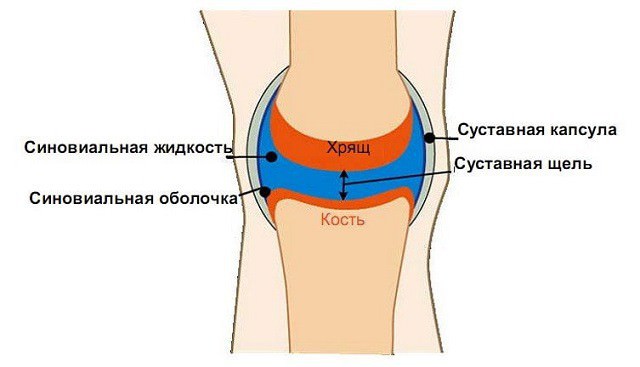 Выпот в полости коленного сустава лечение и виды синовитов