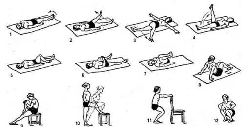 Как разработать ногу после перелома коленного сустава