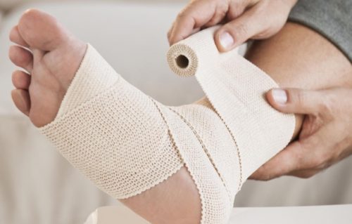 Как правильно наложить фиксирующую повязку на голеностопный сустав