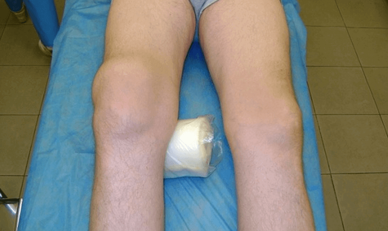 Доктор мясников лечение коленных суставов