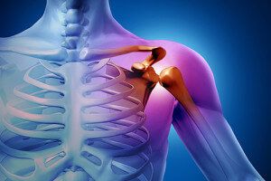 Операция на плечевом суставе привычный вывихОперация на плечевом суставе привычный вывих
