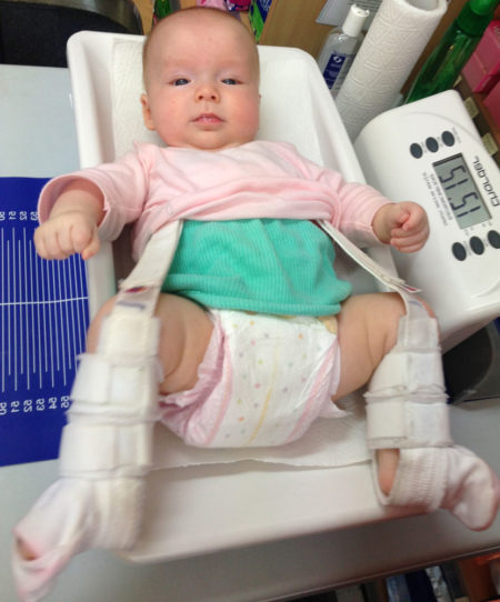 Расшифровка результатов и норма углов на УЗИ тазобедренных суставов у новорожденных и грудничков