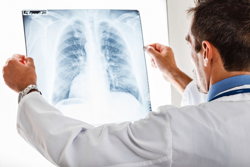 Что такое рентген и зачем он нужен человеку