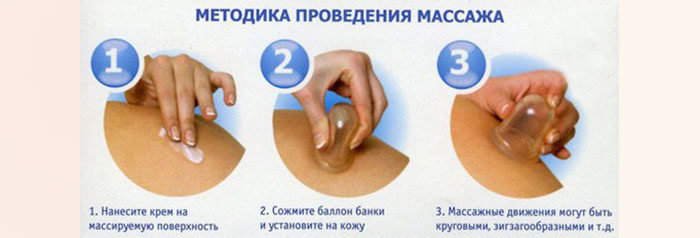 Антицеллюлитный массаж схема выполнения
