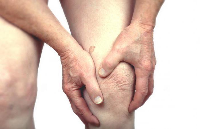 Давайте разберемся, чем отличается артрит от артроза коленного сустава