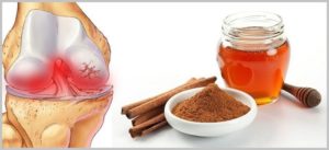 Мед с корицей для суставов лечение рецептом с солью
