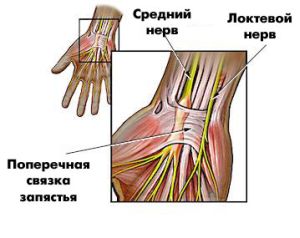 Как лечить растяжение связок и мышц на руке