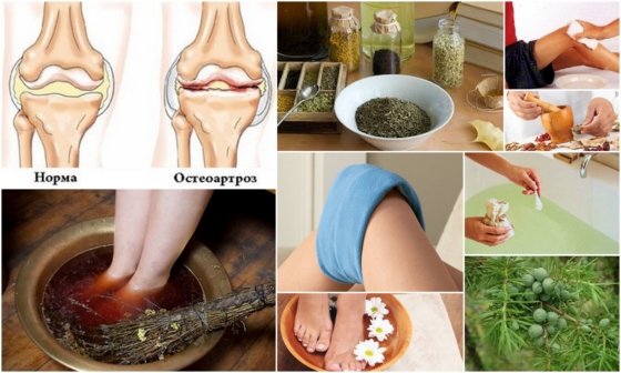 Лечение остеоартроза коленного сустава народными средствами