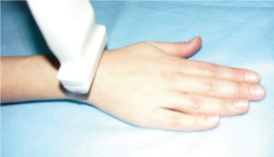 Как лечить разрыв сухожилия на пальце руки