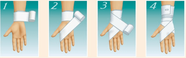 Как правильно наложить повязку на палец