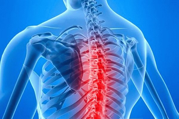 Сенильный остеопороз методы лечения и профилактические меры