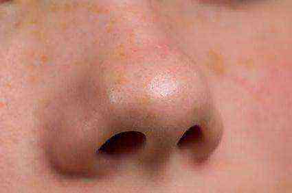 Основные симптомы перелома носа у детей
