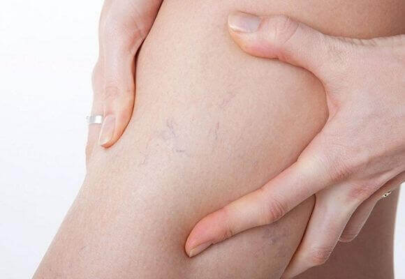 Почему возникает боль в мышцах ног