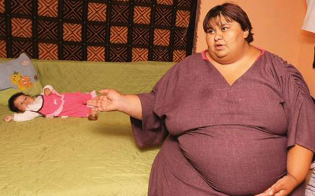 Абдоминальное ожирение у женщин и мужчин: причины, лечение, диета