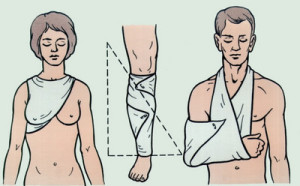 Лечение суставовКак забинтовать плечо эластичным бинтом