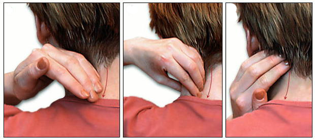 Как делать лечебный массаж шеи при остеохондрозе шейного отдела позвоночника дома?