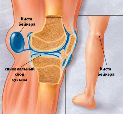 Причины боли в ноге от бедра до колена