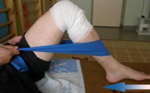 Отек коленного сустава после операции