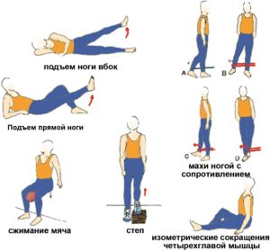 Эффективные упражнения для укрепления коленного сустава