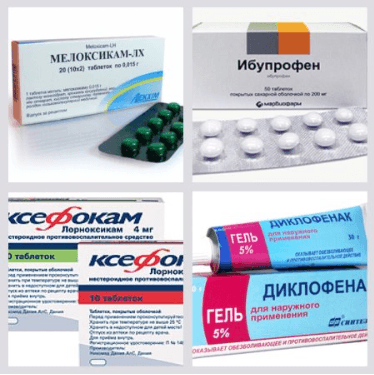 Стероидные и нестероидные противовоспалительные препараты