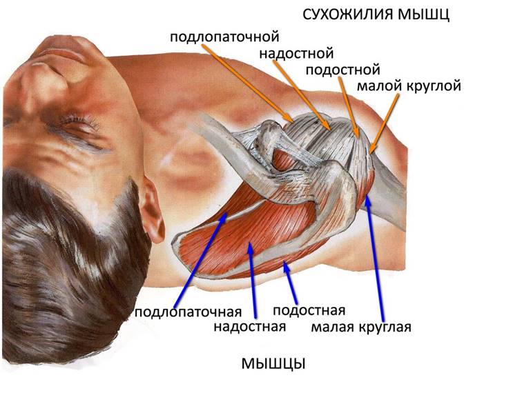 Тренировка с тендинопатией двуглавой мышцы плеча. Часть 1Загрузка