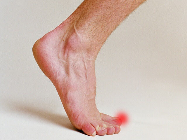 Причины онемения икр ног