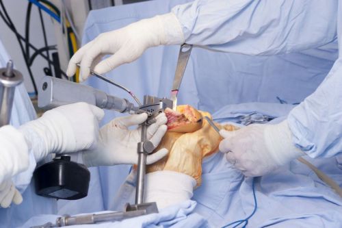 Артроскопия тазобедренного сустава и восстановление после операции