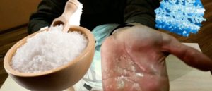 Снег с солью для лечения суставов Видео