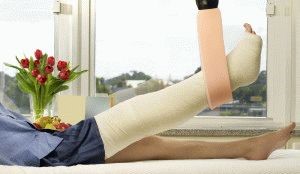 Что делать при сильном отеке и боли после снятия гипса с ноги